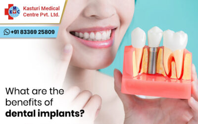 What are the benefits of dental implants?